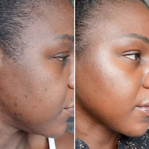 CurrentBody Skin Masque LED visage rouge - Série 2