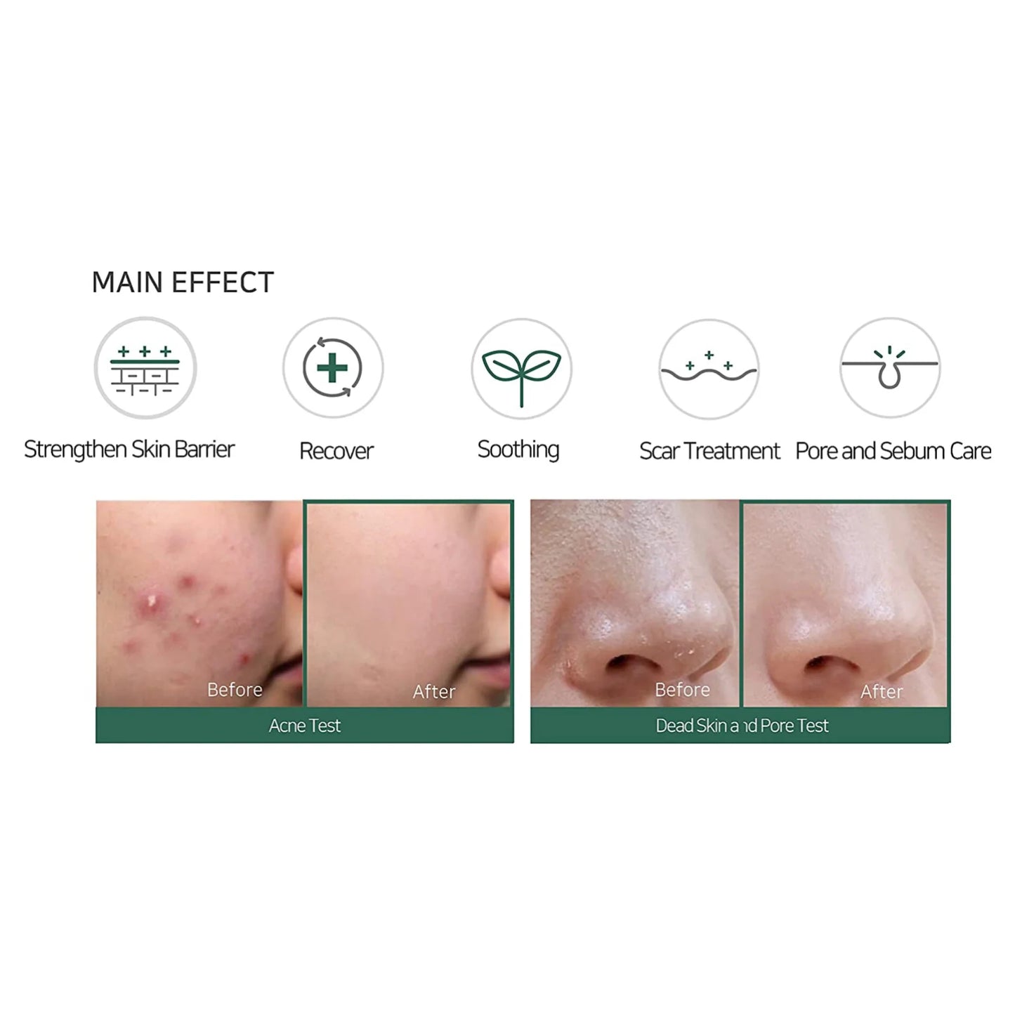 SOME BY MI - AHA BHA PHA 30 Days Miracle Crème