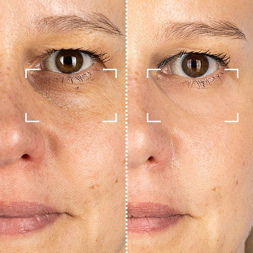 CurrentBody Skin RF Appareil radiofréquence visage