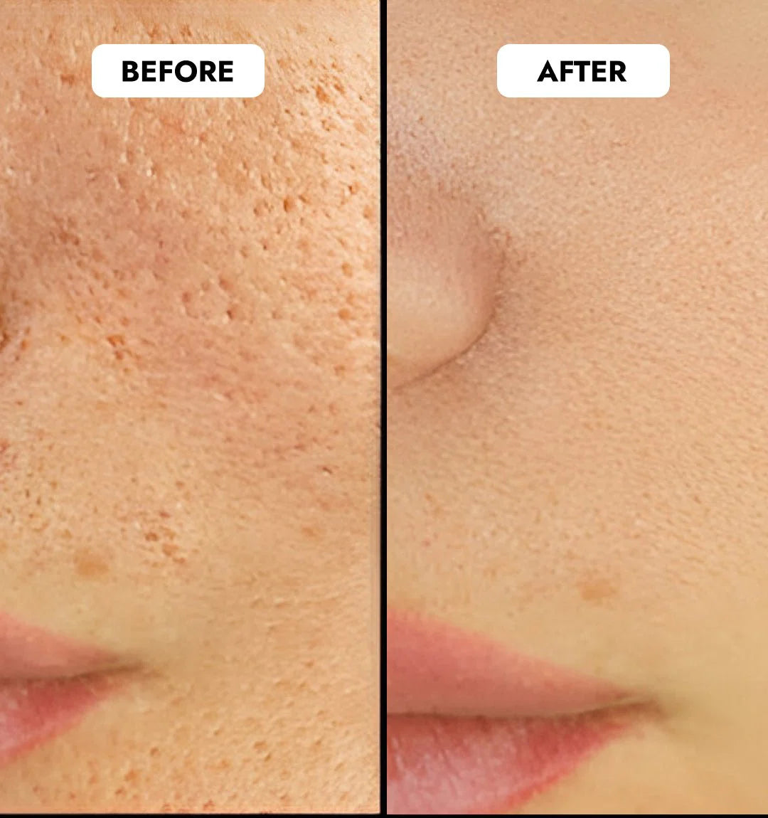 ANUA - Niacinamide 10% + TXA 4% Dark Spot Correcting Serum - 30ml