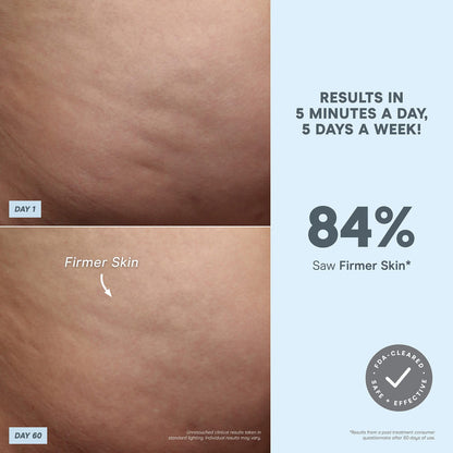 NuBODY – Skin Toning Microcurrent Device for Body | NuFACE