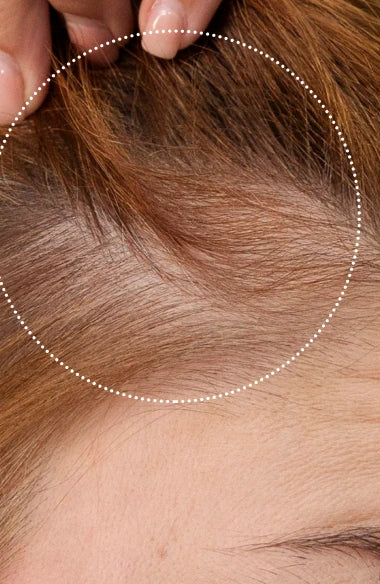 FAQ™ 301 | Appareil à LED rouge pour la repousse des cheveux