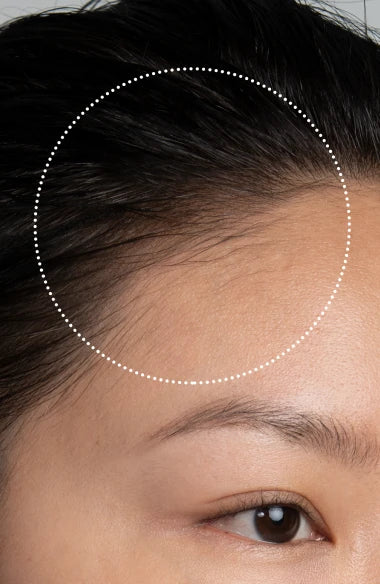 FOREO LUNA™ 4 hair | Red Light Therapy Hair Growth