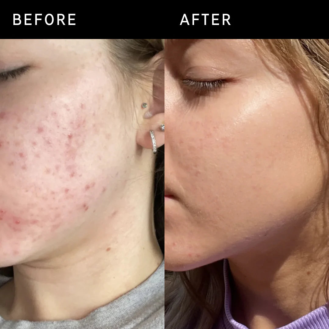 ANUA - Niacinamide 10% + TXA 4% Dark Spot Correcting Serum - 30ml