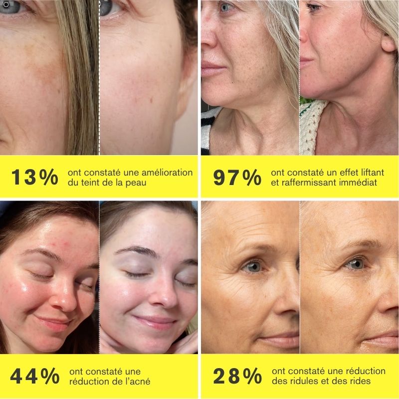 ZIIP HALO 2.0 | Appareil microcourant | Appareil raffermissant visage