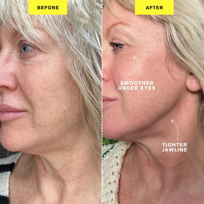 ZIIP HALO - Appareil microcourant | Dispositif de tonification du visage