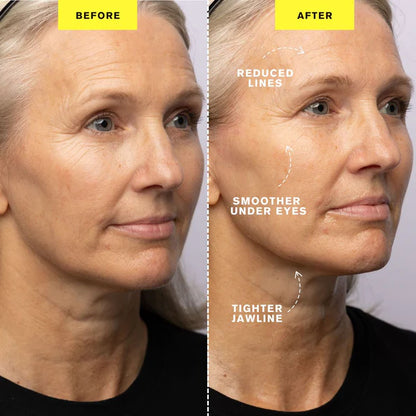 ZIIP HALO - Appareil microcourant | Dispositif de tonification du visage