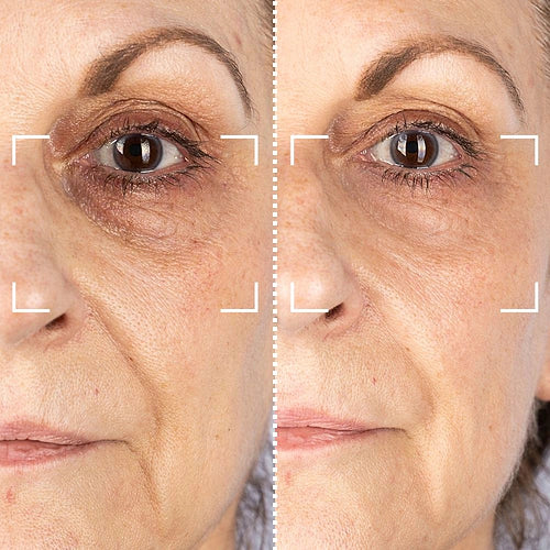 CurrentBody Skin RF Appareil radiofréquence visage