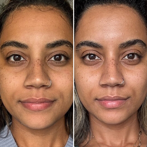 CurrentBody Skin Masque LED visage rouge - Série 2