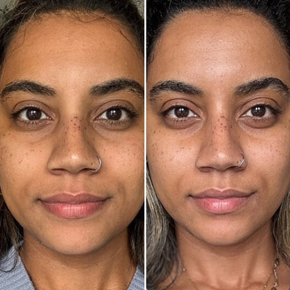 CurrentBody Skin Masque LED visage rouge - Série 2