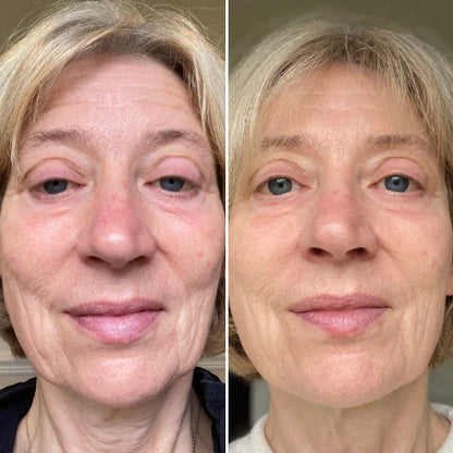 CurrentBody Skin Masque LED visage rouge - Série 2