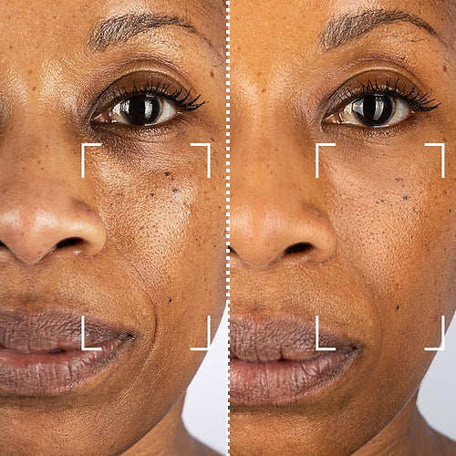 CurrentBody Skin Masque LED visage rouge - Série 1