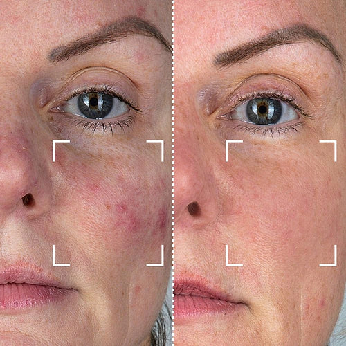 CurrentBody Skin Masque LED visage rouge - Série 1