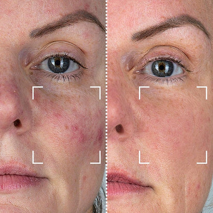 CurrentBody Skin Masque LED visage rouge - Série 1