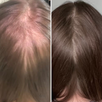 CurrentBody Skin Casque LED repousse cheveux