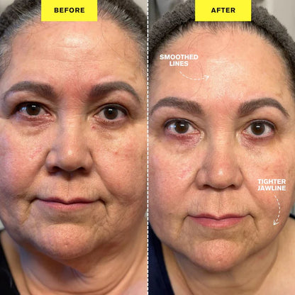 ZIIP HALO - Appareil microcourant | Dispositif de tonification du visage