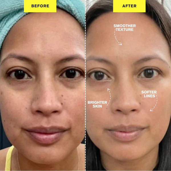 ZIIP HALO - Appareil microcourant | Dispositif de tonification du visage