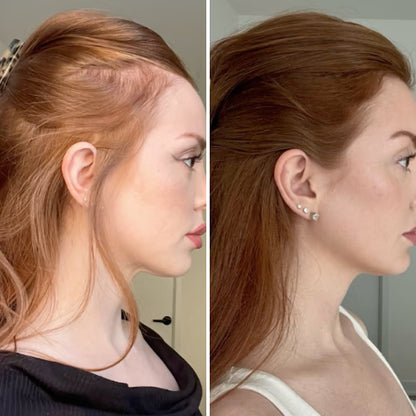 CurrentBody Skin Casque LED repousse cheveux